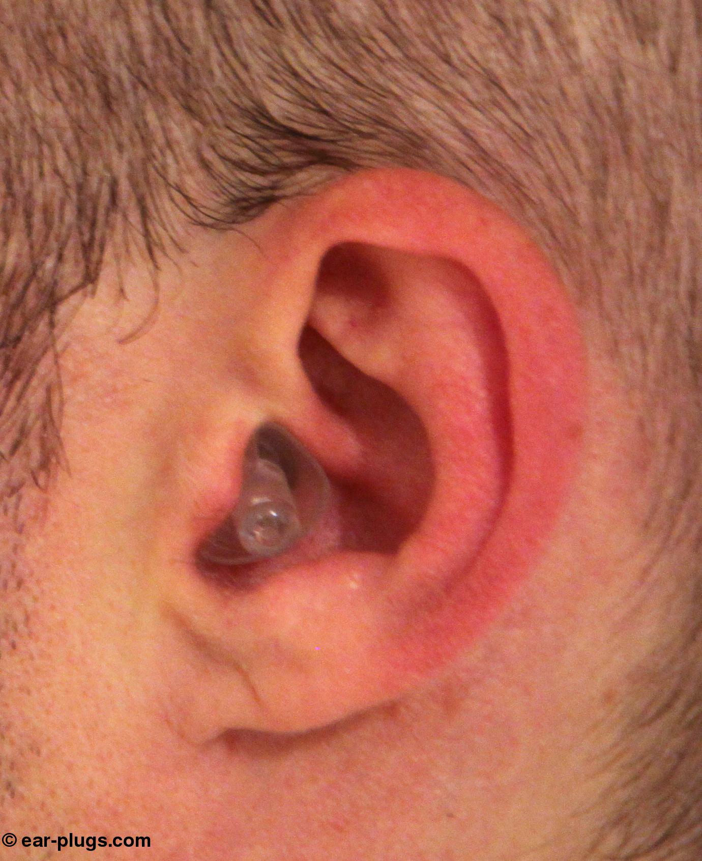Alpine Hearing Protection. Review