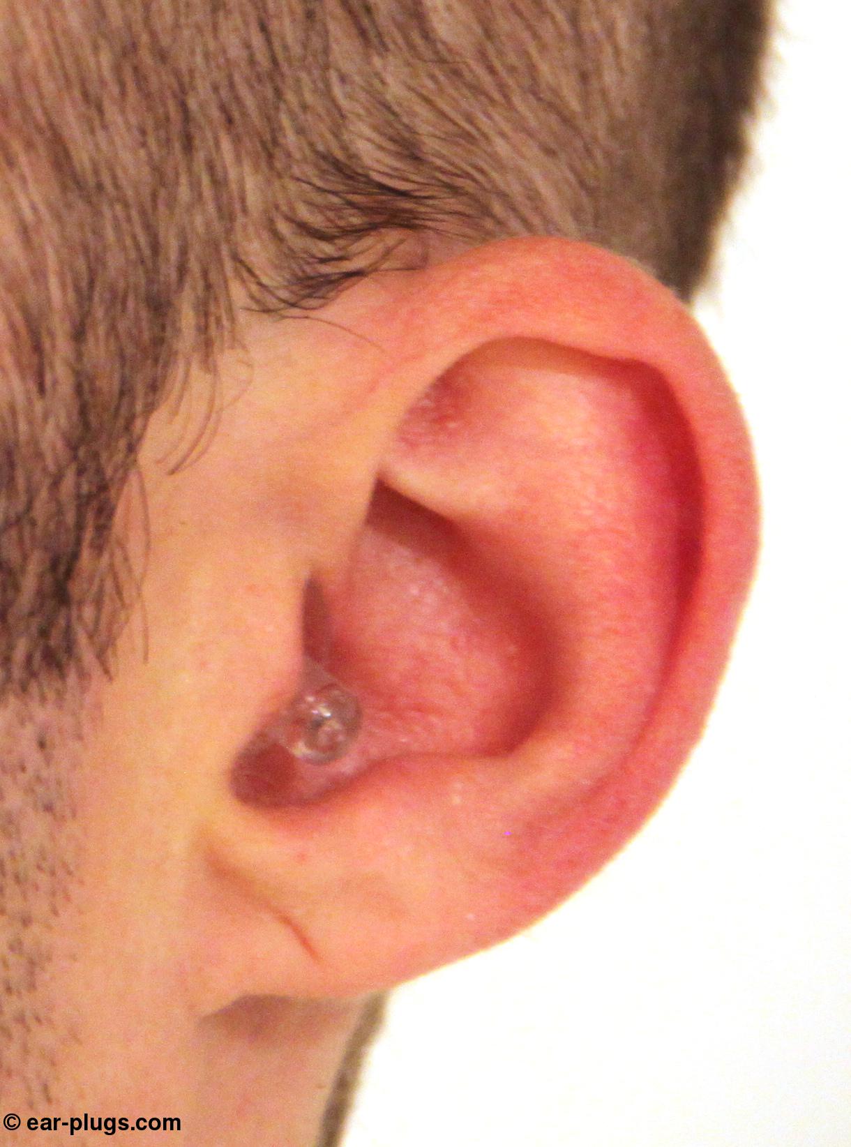 Alpine Hearing Protection. Review
